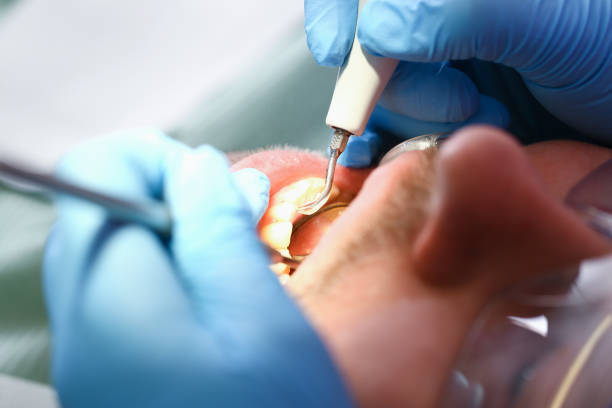 Best Dentist for Dental Trauma  in Schriever, LA
