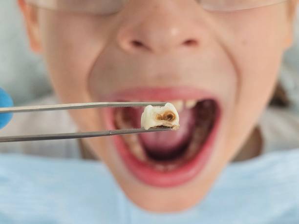 Best Tooth Pain Emergency Relief  in Schriever, LA