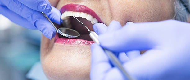 Best Root Canal Emergency Dentist  in Schriever, LA
